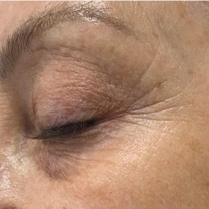 Ultra-Adaptive 5-in-1 Concentrate