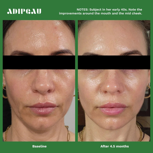 Adipeau Volume Cream
