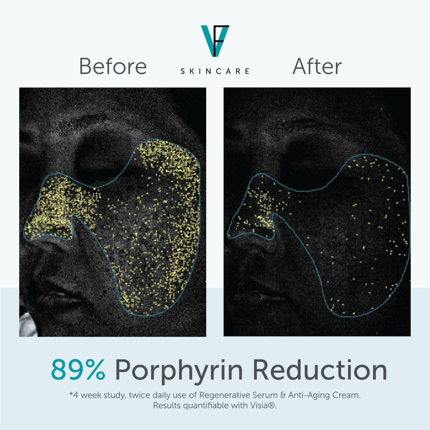 Factor 5 Regenerative Serum