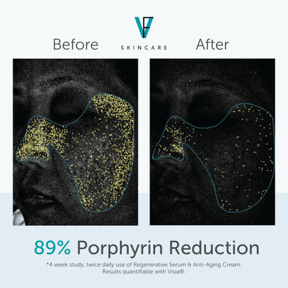 Factor 5 Regenerative Serum
