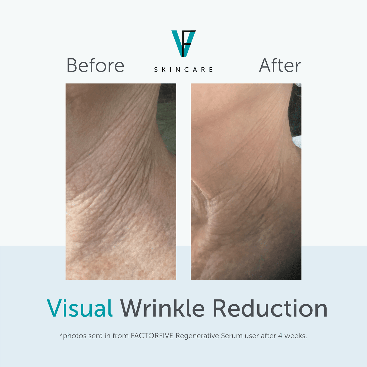 Factor 5 Regenerative Serum