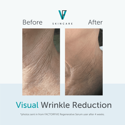Factor 5 Regenerative Serum